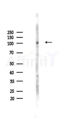 OTUD7B Antibody - Western blot analysis of lysates from Hela cells(LPS,4h treatment), using OTUD7B Antibody at 1/1000 dilution.