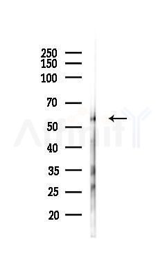 PHGDH Antibody - Western blot analysis of lysates from Mouse testis, using PHGDH Antibody at 1/1000 dilution.