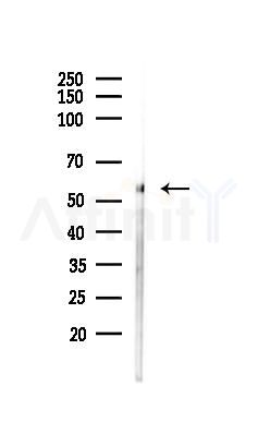 PHGDH Antibody - Western blot analysis of lysates from A375 cells(heat-shock,45min treatment), using PHGDH Antibody at 1/1000 dilution.