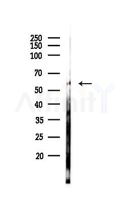 PHGDH Antibody - Western blot analysis of lysates from PC12 cells, using PHGDH Antibody at 1/1000 dilution.
