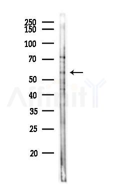ALDH7A1 Antibody - Western blot analysis of lysates from HepG2 cells(heat-shock,45min treatment), using ALDH7A1 Antibody at 1/1000 dilution.