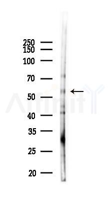 ALDH7A1 Antibody - Western blot analysis of lysates from Mouse liver, using ALDH7A1 Antibody at 1/1000 dilution.