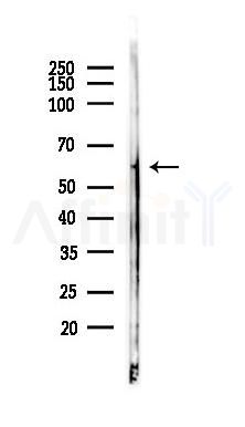 BCO2 Antibody - Western blot analysis of lysates from Rat brain, using BCO2 Antibody at 1/1000 dilution.