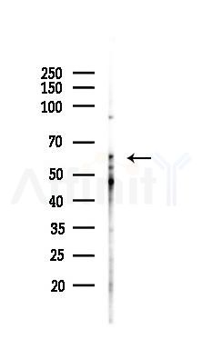 DMAP1 Antibody - Western blot analysis of lysates from A375 cells(heat-shock,45min treatment), using DMAP1 Antibody at 1/1000 dilution.