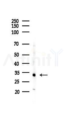 Histone H1.2 Antibody - Western blot analysis of lysates from A375 cells(heat-shock,45min treatment), using Histone H1.