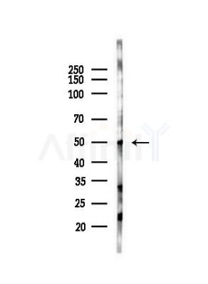 Inhibin beta A Antibody - Western blot analysis of lysates from HUVEC cells(LPS, 4h treatment), using Inhibin beta A Antibody at 1/1000 dilution.