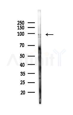 PYGB Antibody - Western blot analysis of lysates from A375 cells(heat-shock,45min treatment), using PYGB Antibody at 1/1000 dilution.
