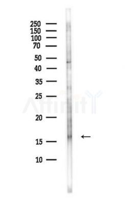 SH2D1B Antibody - Western blot analysis of lysates from Hela cells(starvation,24h treatment), using SH2D1B Antibody at 1/1000 dilution.