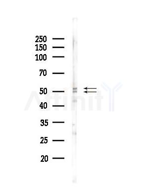 CFHR3 Antibody - Western blot analysis of lysates from EC304 cells(heat-shock,45min treatment), using CFHR3 Antibody at 1/1000 dilution.
