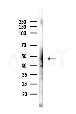 DOPA decarboxylase Antibody - Western blot analysis of lysates from A375 cells(heat-shock,45min treatment), using DOPA decarboxylase Antibody at 1/1000 dilution.