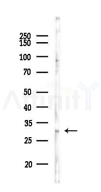 ETFA Antibody - Western blot analysis of lysates from HepG2 cells(heat-shock,45min treatment), using ETFA Antibody at 1/1000 dilution.