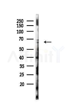 FBXW7 Antibody - Western blot analysis of lysates from A375 cells(heat-shock,45min treatment), using FBXW7 Antibody at 1/1000 dilution.