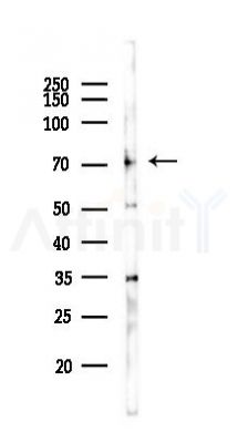 FXR1 Antibody - Western blot analysis of lysates from A375 cells(heat-shock,45min treatment), using FXR1 Antibody at 1/1000 dilution.
