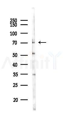 FXR1 Antibody - Western blot analysis of lysates from HepG2 cells(heat-shock,45min treatment), using FXR1 Antibody at 1/1000 dilution.