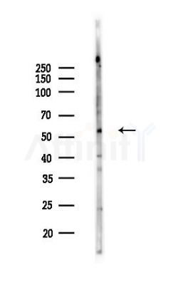 OMA1 Antibody - Western blot analysis of lysates from K562 cells(UV,30min treatment), using OMA1 Antibody at 1/1000 dilution.