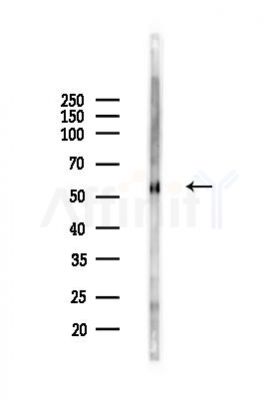 OMA1 Antibody - Western blot analysis of lysates from Rat brain, using OMA1 Antibody at 1/1000 dilution.
