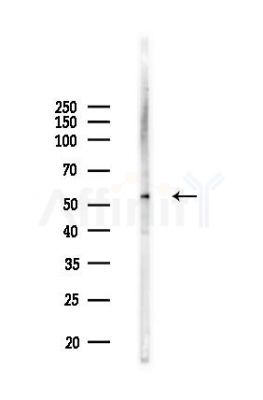 OMA1 Antibody - Western blot analysis of lysates from B16F10-LUC cells(UV,30min treatment), using OMA1 Antibody at 1/1000 dilution.