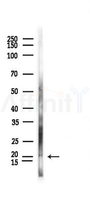 OPA3 Antibody - Western blot analysis of lysates from Rat lung, using OPA3 Antibody at 1/1000 dilution.