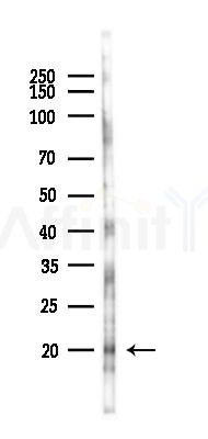 PTP4A1/PRL1 Antibody - Western blot analysis of lysates from 293 cells(UV,30min treatment), using PTP4A1/PRL1 Antibody at 1/1000 dilution.
