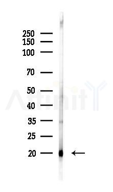 Rab3A Antibody - Western blot analysis of lysates from A375 cells(heat-shock,45min treatment), using Rab3A Antibody at 1/1000 dilution.