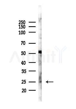 Rab3A Antibody - Western blot analysis of lysates from LoVo cells(heat-shock,45min treatment), using Rab3A Antibody at 1/1000 dilution.