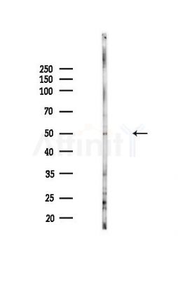 SMYD3 Antibody - Western blot analysis of lysates from Hela cells(heat-shock,45min treatment), using SMYD3 Antibody at 1/1000 dilution.