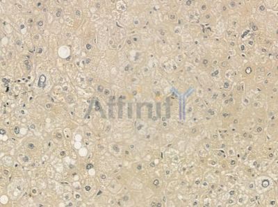 TBC1D23 Antibody - DF12484 at 1/100 staining human normal liver tissue by IHC-P.