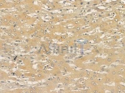 TCTN2 Antibody - DF12485 at 1/100 staining human normal lung tissue by IHC-P.