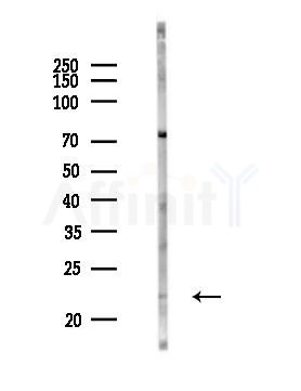 TMEM70 Antibody - Western blot analysis of lysates from Rat lung, using TMEM70 Antibody at 1/1000 dilution.