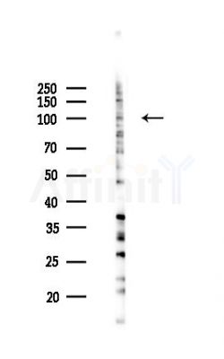 USP33 Antibody - Western blot analysis of lysates from K562 cells(UV,30min treatment), using USP33 Antibody at 1/1000 dilution.