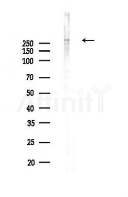 USP9X Antibody - Western blot analysis of lysates from K562 cells(UV,30min treatment), using USP9X Antibody at 1/1000 dilution.