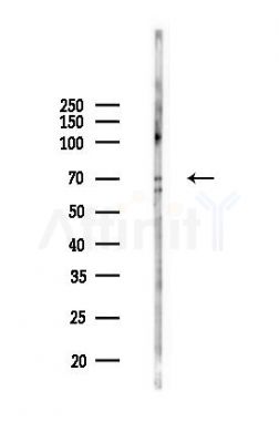 WRAP53 Antibody - Western blot analysis of lysates from K562 cells(UV,30min treatment), using WRAP53 Antibody at 1/1000 dilution.