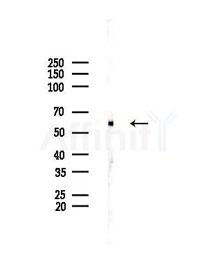 NELF-A Antibody - Western blot analysis of lysates from A375 cells(heat-shock,45min treatment), using NELF-A Antibody at 1/1000 dilution.