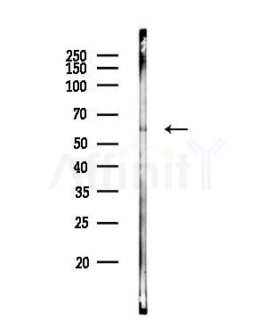 NELF-A Antibody - Western blot analysis of lysates from A549 cells, using NELF-A Antibody at 1/1000 dilution.