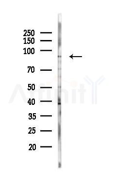 PIWL1 Antibody - Western blot analysis of lysates from A375 cells(heat-shock,45min treatment), using PIWL1 Antibody at 1/1000 dilution.