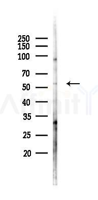 RASSF10 Antibody - Western blot analysis of lysates from Hela cells(LPS, 4h treatment), using RASSF10 Antibody at 1/1000 dilution.