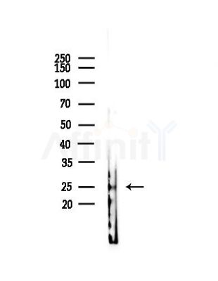 TREM2 Antibody - Western blot analysis of lysates from HepG2 cells(heat-shock,45min treatment), using TREM2 Antibody at 1/1000 dilution.
