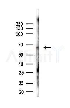 TNR11 Antibody - Western blot analysis of lysates from LoVo cells(heat-shock,45min treatment), using TNR11 Antibody at 1/1000 dilution.