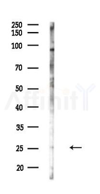CXCL2 Antibody - Western blot analysis of lysates from COLO205 cells(heat-shock,45min treatment), using CXCL2 Antibody at 1/1000 dilution.