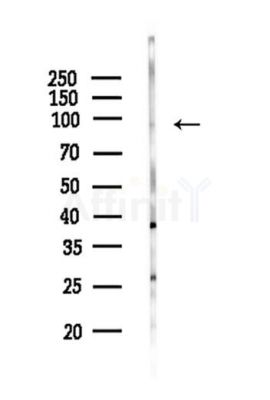 USP5 Antibody - Western blot analysis of lysates from HepG2 cells(starvation,24h treatment), using USP5 Antibody at 1/1000 dilution.