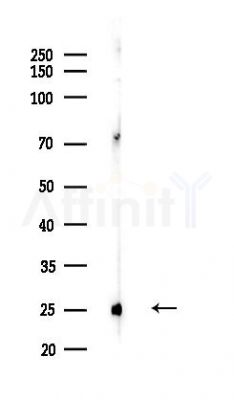 ARL15 Antibody - Western blot analysis of lysates from COLO205 cells(heat-shock,45min treatment), using ARL15 Antibody at 1/1000 dilution.