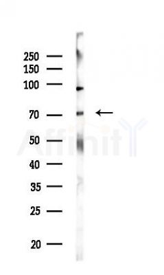 CBFA2T3 Antibody - Western blot analysis of lysates from HUVEC cells(LPS,4h treatment), using CBFA2T3 Antibody at 1/1000 dilution.