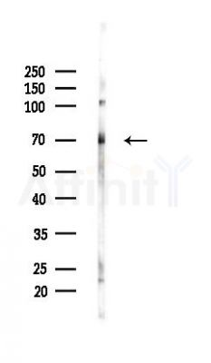 CBFA2T3 Antibody - Western blot analysis of lysates from Mouse testis, using CBFA2T3 Antibody at 1/1000 dilution.