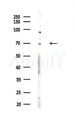 CBFA2T3 Antibody - Western blot analysis of lysates from COLO205 cells(heat-shock,45min treatment), using CBFA2T3 Antibody at 1/1000 dilution.