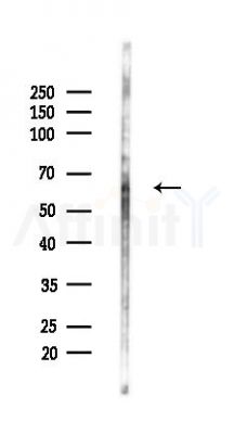 CBLL1 Antibody - Western blot analysis of lysates from Mouse testis, using CBLL1 Antibody at 1/1000 dilution.