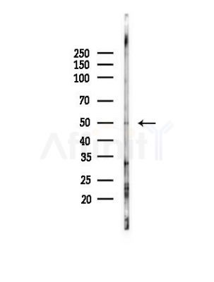 CDR2L Antibody - Western blot analysis of lysates from Mouse lung, using CDR2L Antibody at 1/1000 dilution.