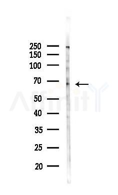CES3 Antibody - Western blot analysis of lysates from Hela cells(starvation,24h treatment), using CES3 Antibody at 1/1000 dilution.