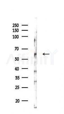 CORO1C Antibody - Western blot analysis of lysates from HUVEC cells(LPS,4h treatment), using CORO1C Antibody at 1/1000 dilution.