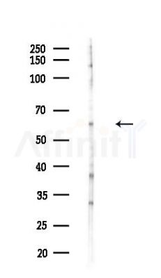 CORO1C Antibody - Western blot analysis of lysates from COLO205 cells(heat-shock,45min treatment), using CORO1C Antibody at 1/1000 dilution.