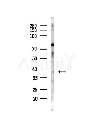 CPOX Antibody - Western blot analysis of lysates from HepG2 cells(starvation,24h treatment), using CPOX Antibody at 1/1000 dilution.